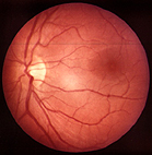 L'immagine di una retina